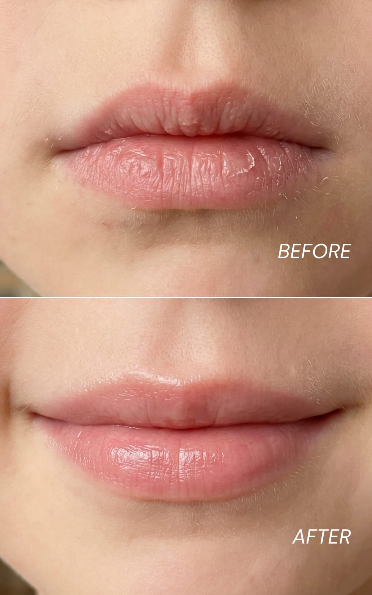 Moisturising Lip Butter