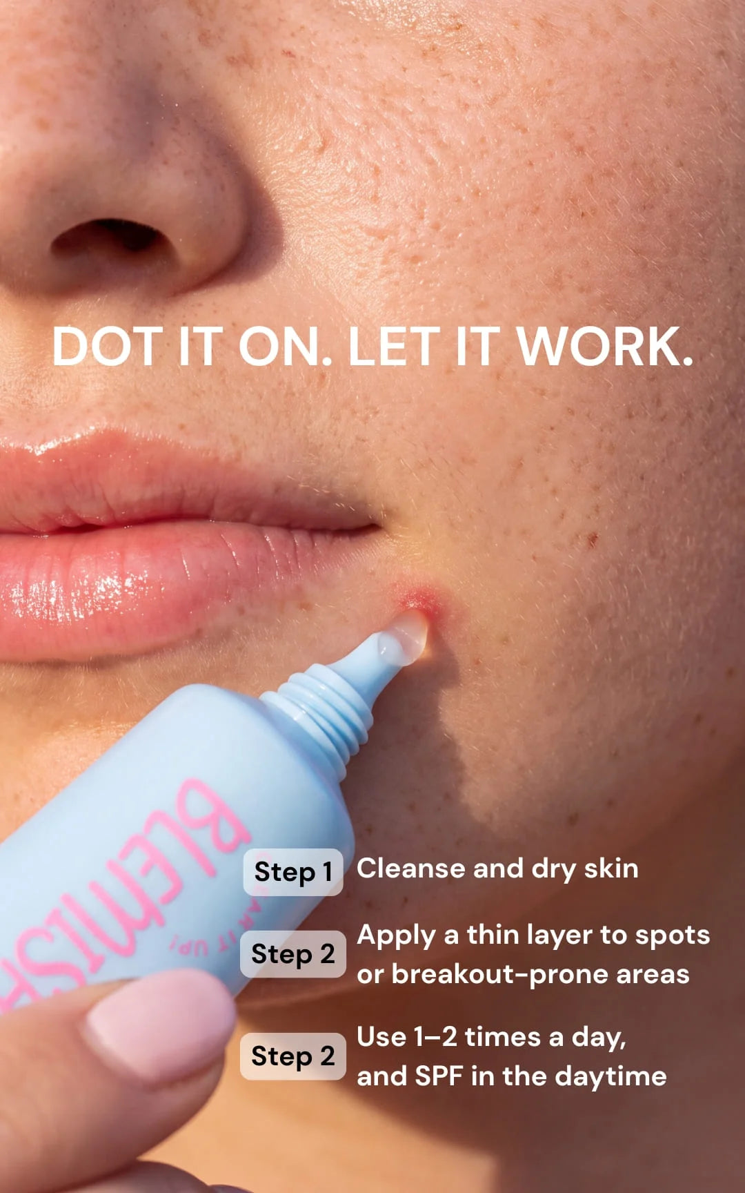 Clear It Up! Blemish Control Teen Gel